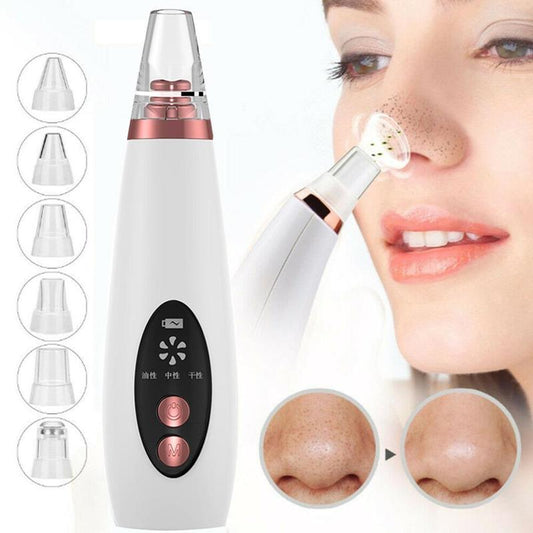 Blackhead remover vacuum pore cleaner microcrystalline acne suction facial skincare device deep cleaning tool